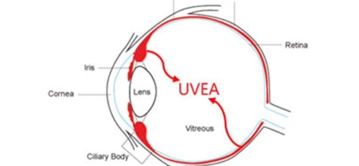 vitreous, retina, Uvea