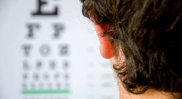 refractive errors of the eye