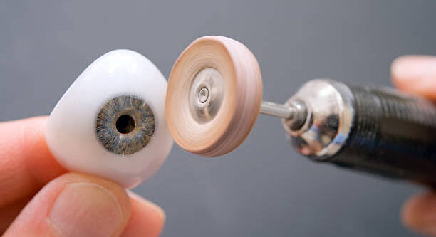 Prosthetic eye