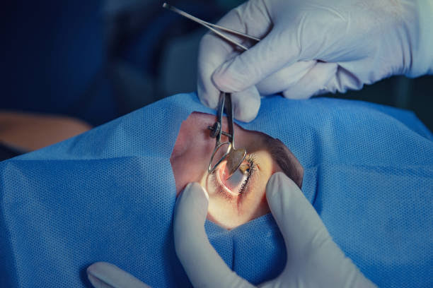 glaucoma surgery